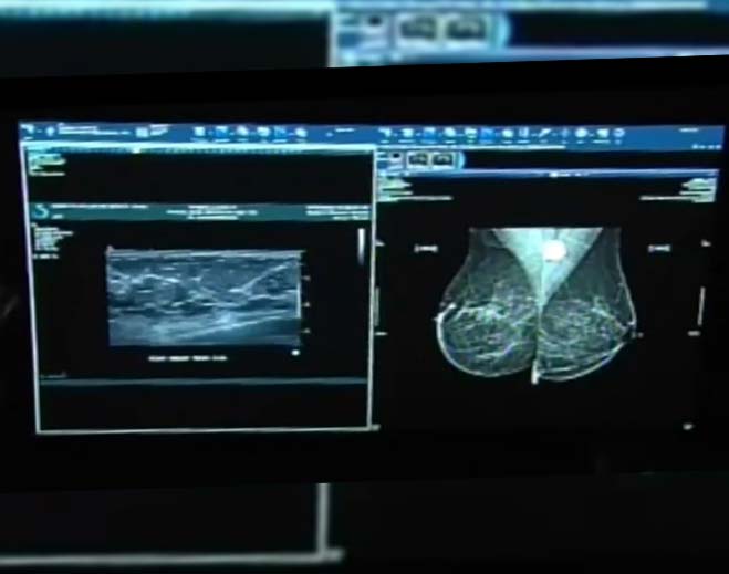 false-positives-in-mammograms-can-be-caused-after-getting-the-covid-vaccine